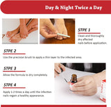 Fungal Nail Treatment