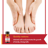 Fungal Nail Treatment for Toenails Extra Strong Lopsx Nail Fungus Treatment Toe Nail Fungal Treatment for Thick, Discolored Nails 10ml