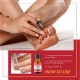 Fungal Nail Treatment for Toenails Extra Strong Lopsx Nail Fungus Treatment Toe Nail Fungal Treatment for Thick, Discolored Nails 10ml