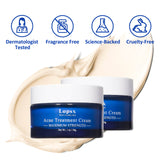 Acne Treatment Cream