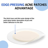 Upgrade Acne Patches(72 count)